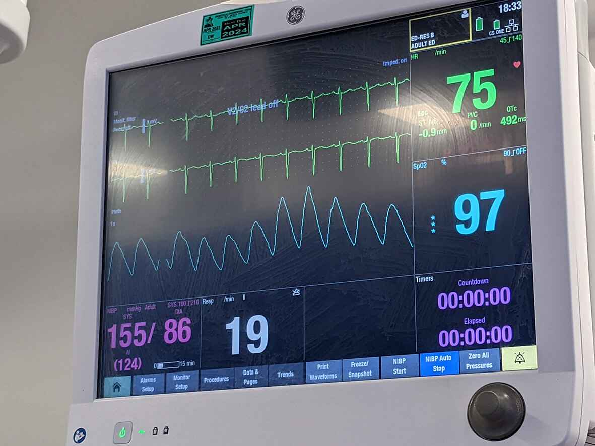 Normal blood pressure 155 - Healing High Blood Pressure Naturally, pure energy healing session with earth element